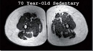 70-yr-sedentary