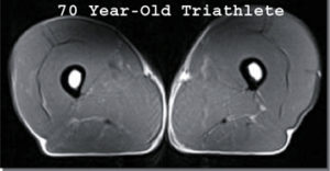 70 year old triathlete